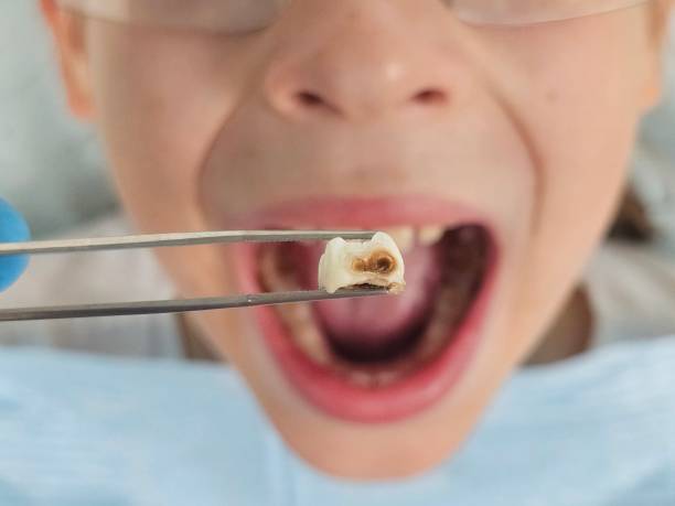 Best Emergency Denture Repair in Bull Valley, IL